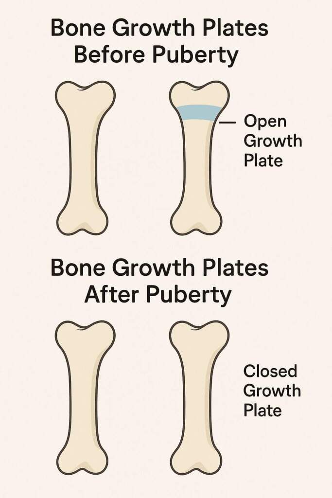 Bone growth plates before and after puberty